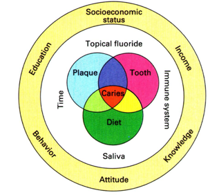 What Causes Cavities?